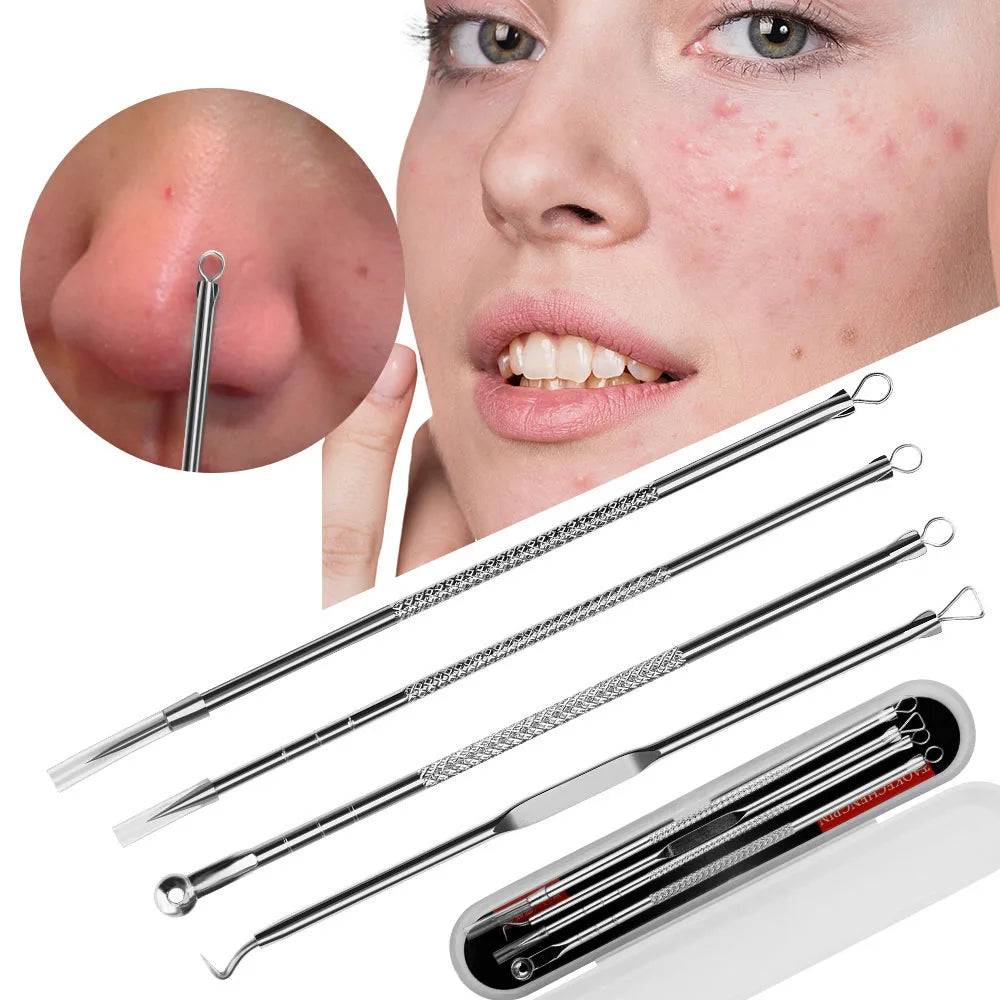 Pimples &amp; Blackhead Remover Needle – Professional Stainless Steel Acne Tool